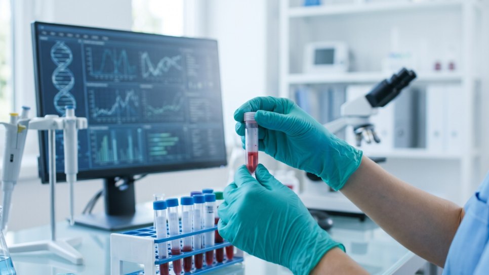 Can ctDNA Testing in Breast Cancer Detect Recurrence Before It Is Evident Pathologically?