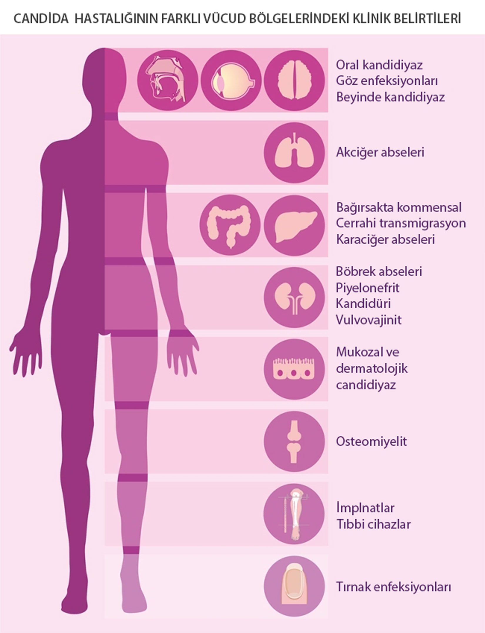 Wie zeigt sich eine Candida-Infektion in verschiedenen Körperregionen? Candidose