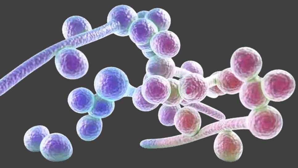 Was ist Candida? Symptome, Ursachen und Behandlung