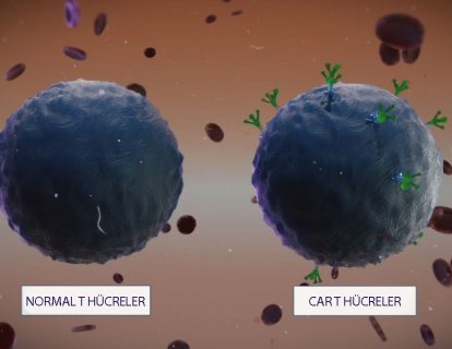 CAR T Hücre İmmünoterapisinin Organ Kanserlerinde Kullanımında Önemli Gelişmeler