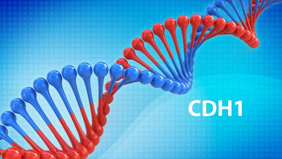 Was ist eine CDH1-Genmutation? Welche Krebsrisiken erhöht sie?