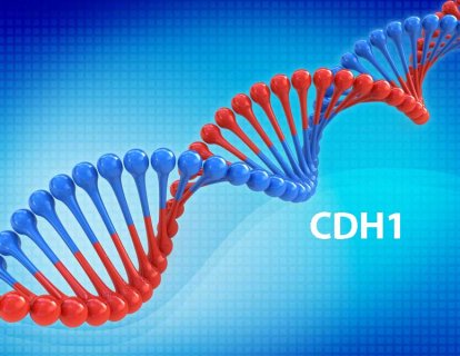 CDH1 gen mutasyonu nedir? Hangi kanserlerin riskini artırır?