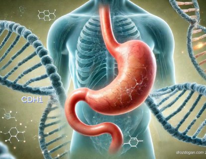 CDH1 Mutasyonu Taşıyıcılarında Yaşam Boyu Mide Kanseri Riski Nedir?