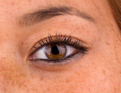 İleri evre yassı hücreli cilt kanseri tedavisinde immünoterapi Cemiplimab