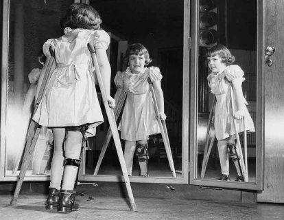 Çocuk Felci Aşısı 1955 – Polio Virüsü
