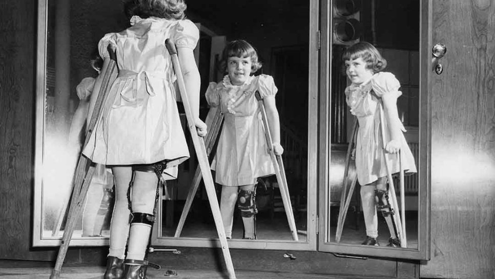 The Polio Vaccine 1955 – Poliovirus