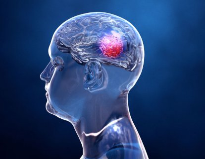 Çocukluk Çağı Beyin Tümörleri için Dabrafenib-Trametinib Kombinasyonu FDA Onayı Aldı