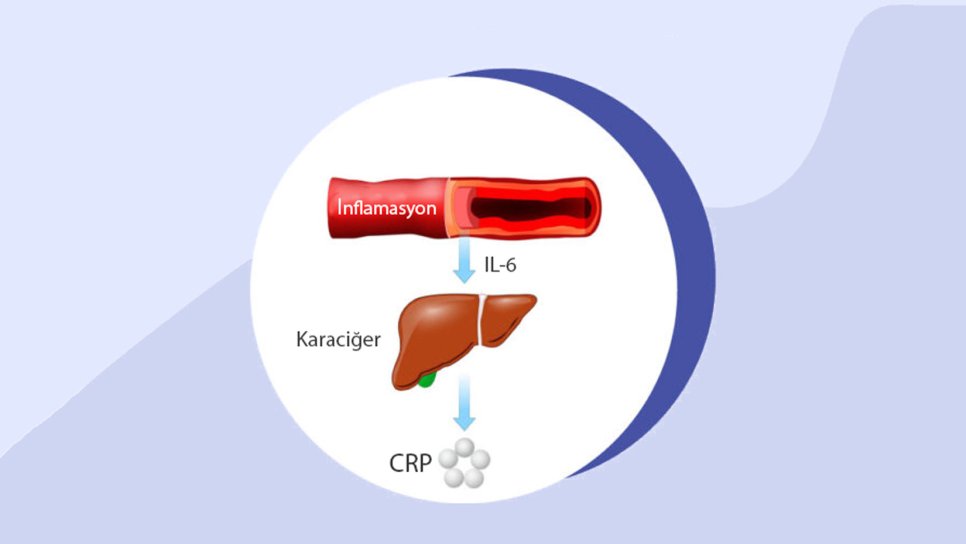 CRP nedir? CRP Testi Yüksekliği ya da Düşüklüğü Ne Anlama Gelir?