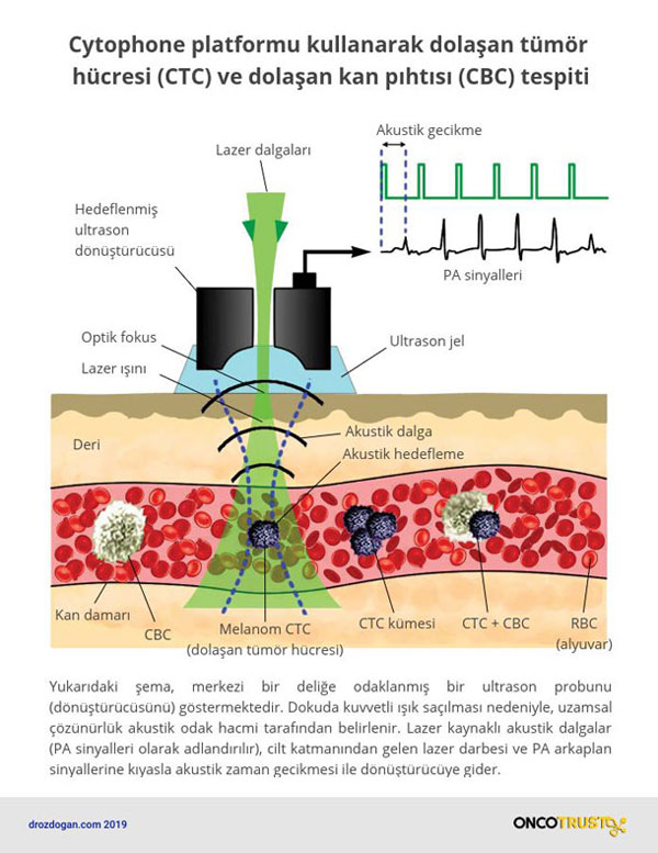 cytophone platformu kullanarak dolasan tumor hucresi ctc ve dolasan kan pihtisi cbc tespiti 554863