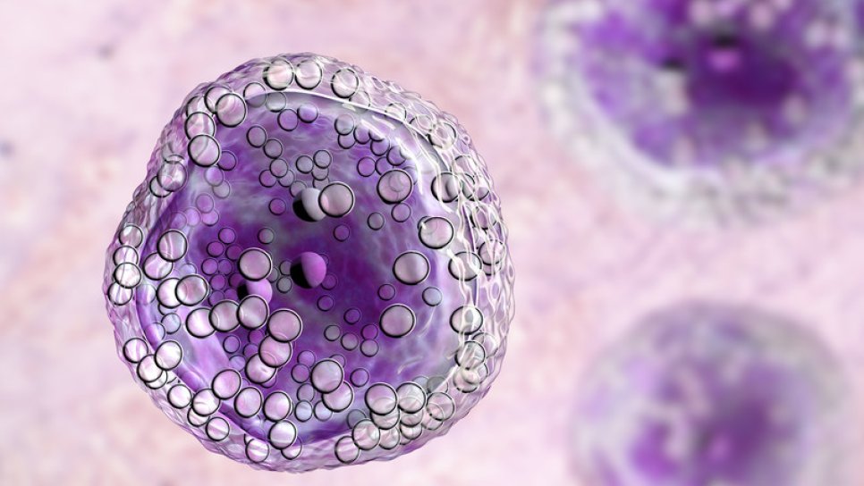 Neue Zulassung beim diffusen großzelligen B-Zell-Lymphom: Tafasitamab-cxix