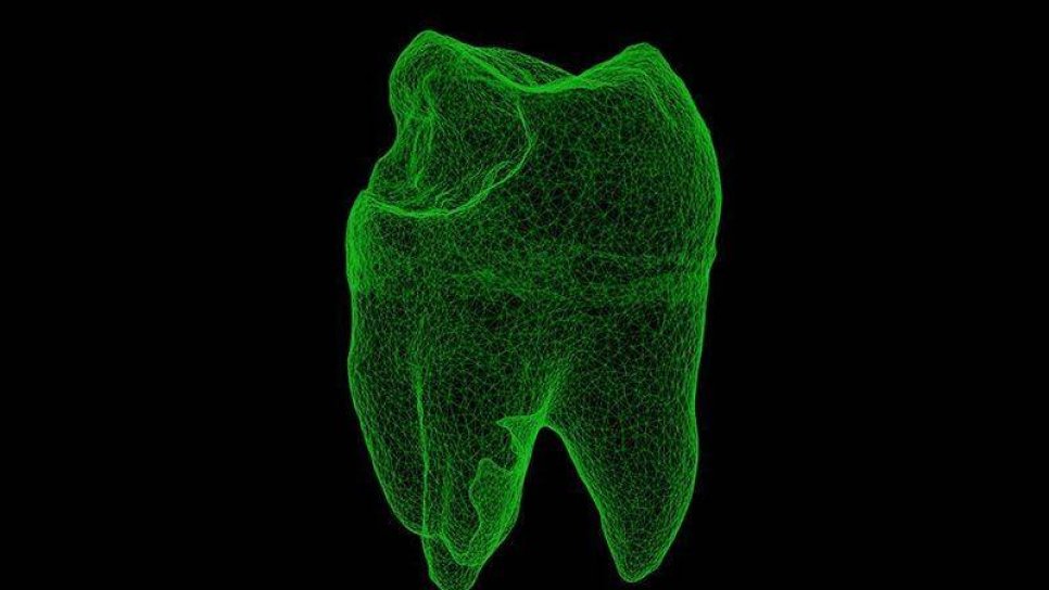 Diş Eti - Periodontal Hastalığı Birçok Kanser İçin Risk Oluşturuyor