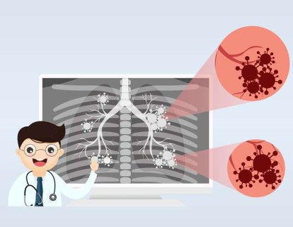 E-Sigaralar, Nasıl Akciğer Hastalığı Yapıyor?