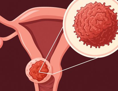Elahere (mirvetuximab soravtansine) Nedir? FDA Onayı, Türkiye Ruhsatı ve Geri Ödeme Durumu