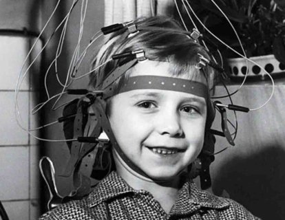 Elektroensefalogram (EEG) 1924 – Beynin Elektriksel Aktivitesinin İzlenmesi