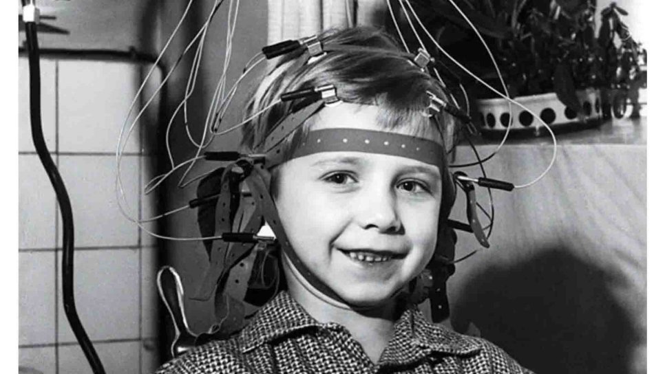 Electroencephalogram (EEG) 1924 – Monitoring the Brain's Electrical Activity