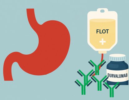 Erken Evre Mide Kanserinde Durvalumab artı FLOT ile İlk Kez Genel Sağkalım Farkı