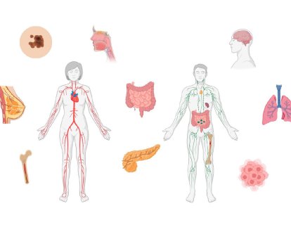 FAPI PET Hangi Kanserlerde Klasik FDG PET Taramaya Üstündür?