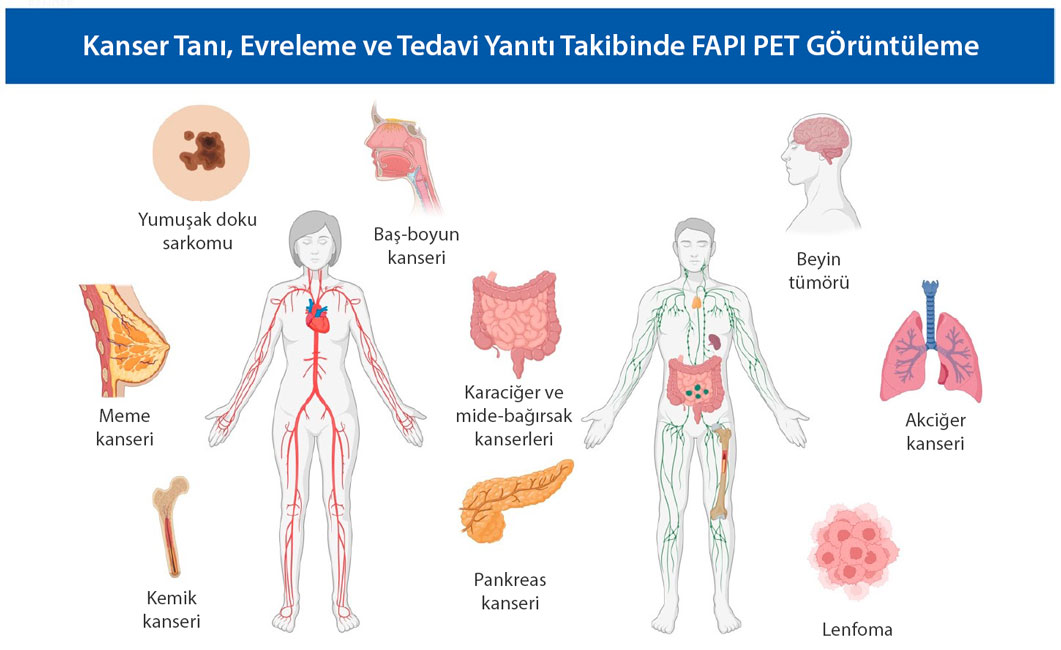fapi pet hansı xərçənglərdə tətbiq oluna bilər və uğurludur