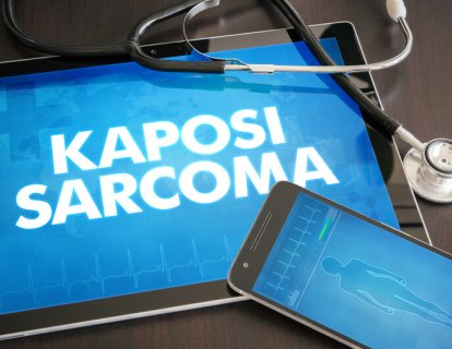FDA, Kaposi Sarkomu İçin Pomalidomide Hızlandırılmış Onay Verdi