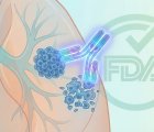 FDA, Tarlatamab'a Küçük Hücreli Akciğer Kanseri İkinci Basamak Tedavisinde Tam Onay Verdi