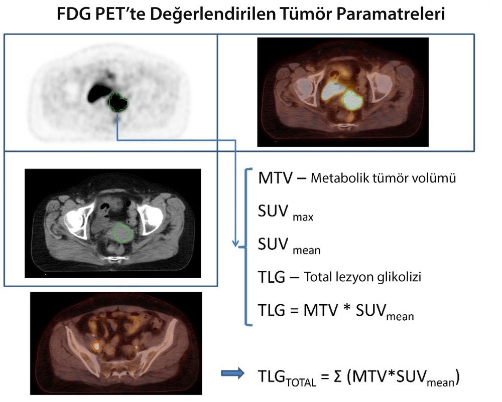 fdg pet ile degerlendirilen tumor paramatreleri nelerdir suv max mean 525369