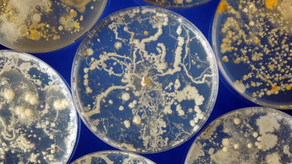 Fekal transplant (dışkı nakli) sonrası bir hastanın yaşamını kaybetmesi üzerine FDA uyardı