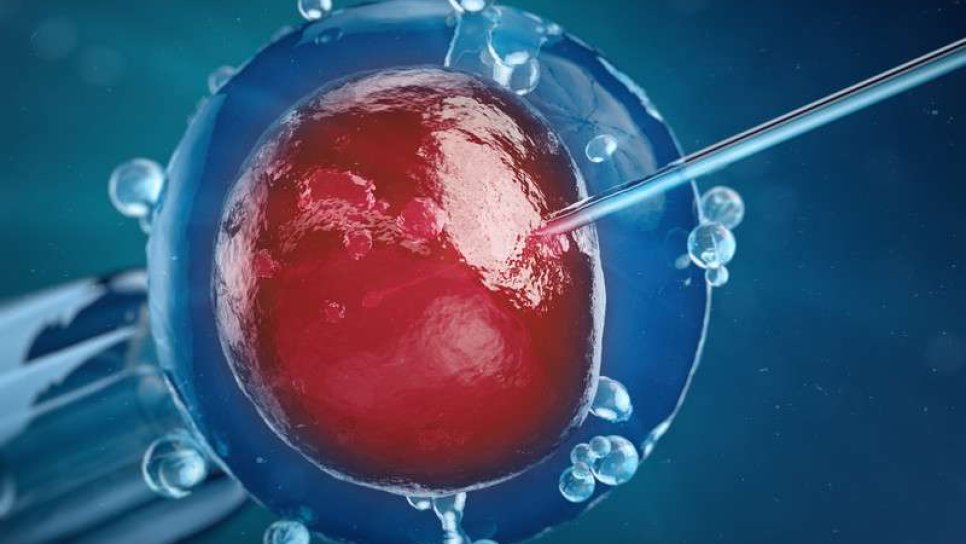 Fertilite-Kısırlık Tedavisi ve Teknolojileri Over Kanseri Riskini Arttırır Mı?