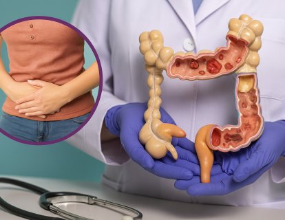 Kolon Kanserinde FOLFİRİ ve Altuzan (Bevasizumab) Tedavi Rejimi