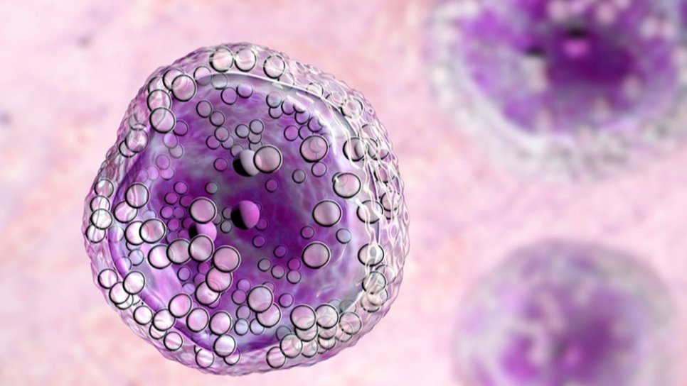 Foliküler Lenfomada Sınıfının İlk Bispesifik Antikoru Mosunetuzumab-axgb FDA Onayı Aldı