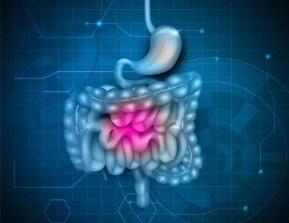 Gastrointestinal stromal tümör (GIST) tedavisi için avapritinib FDA onayı aldı
