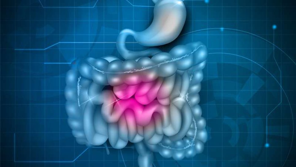 Gastrointestinal stromal tümör (GIST) tedavisi için avapritinib FDA onayı aldı