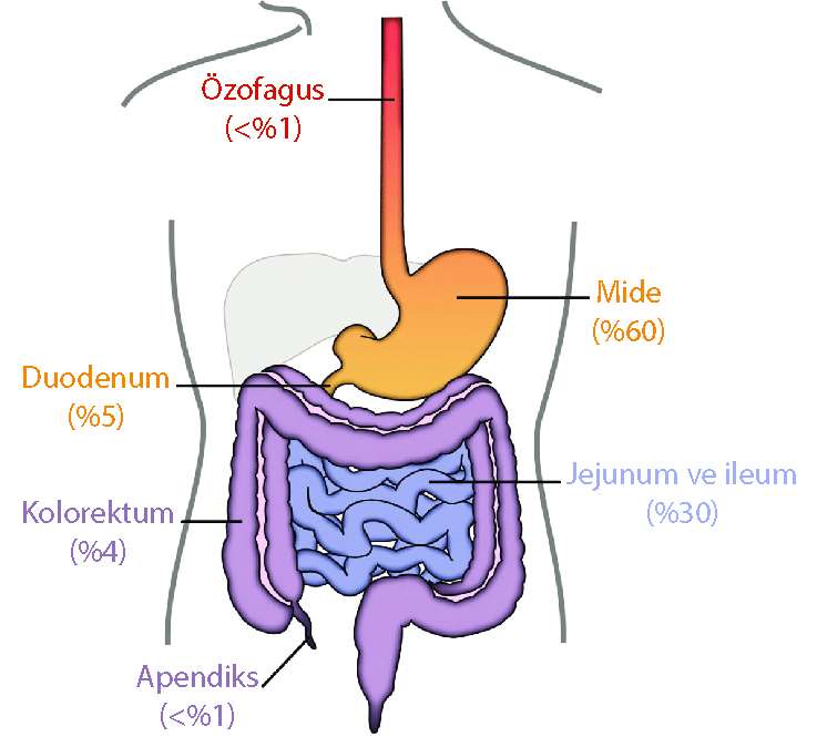 Anatomische Lokalisation gastrointestinaler Stromatumoren