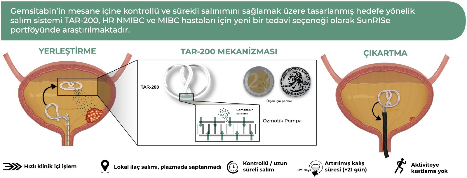 sidik kisəsi xərçəngində gemsitabin
