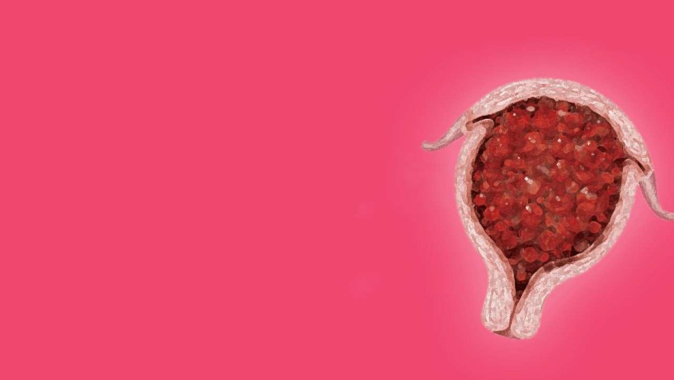 Nadir Bir Kanser Türünde Daha İmmünoterapi Umut Oldu