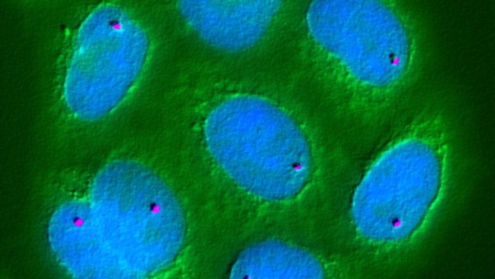 Glutathion und Krebs – Den Schleier des Geheimnisses mit Wissenschaft lüften