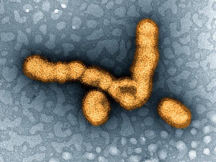 Grippe Influenza