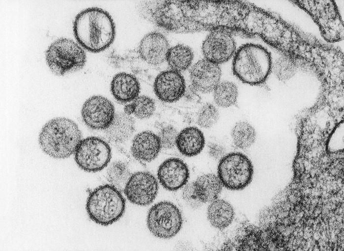 hanta virus 654438