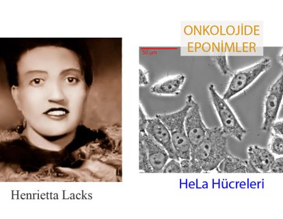 HeLa Hücreleri: Kanserde Yeni Tedavi Arayışlarını Destekleyen Ölümsüz Bir Kadının Hikayesi