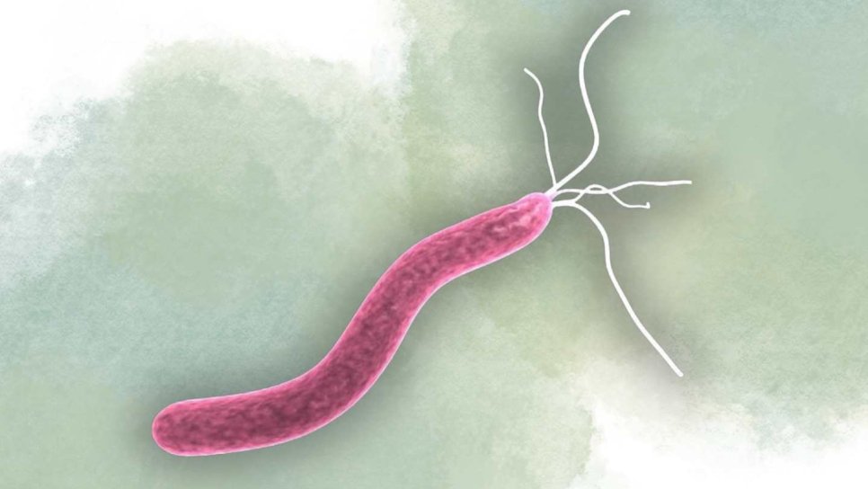 Ulcerele peptice și bacteriile 1984 – Helicobacter Pylori