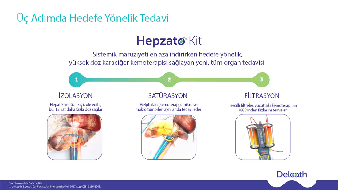 HEPZATO KIT: mechanism of intra-arterial melphalan delivery to the liver in uveal melanoma