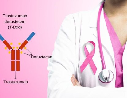 HER2-düşük Meme Kanseri için Trastuzumab Deruxtecan (Enhertu) FDA Onayı Aldı