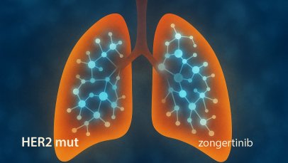 A New Era in HER2-Mutant Lung Cancer: Zongertinib Receives FDA Accelerated Approval
