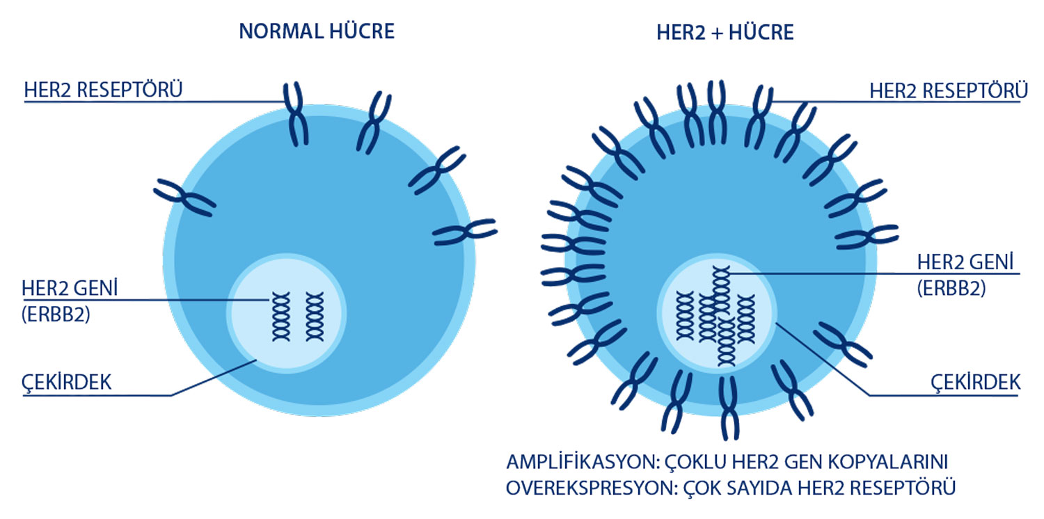 What are HER2 receptor overexpression, amplification and mutation? ERBB2 gene