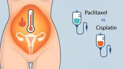 HIPEC in Ovarian Cancer: Paclitaxel or Cisplatin for Heated Intraperitoneal Chemotherapy?