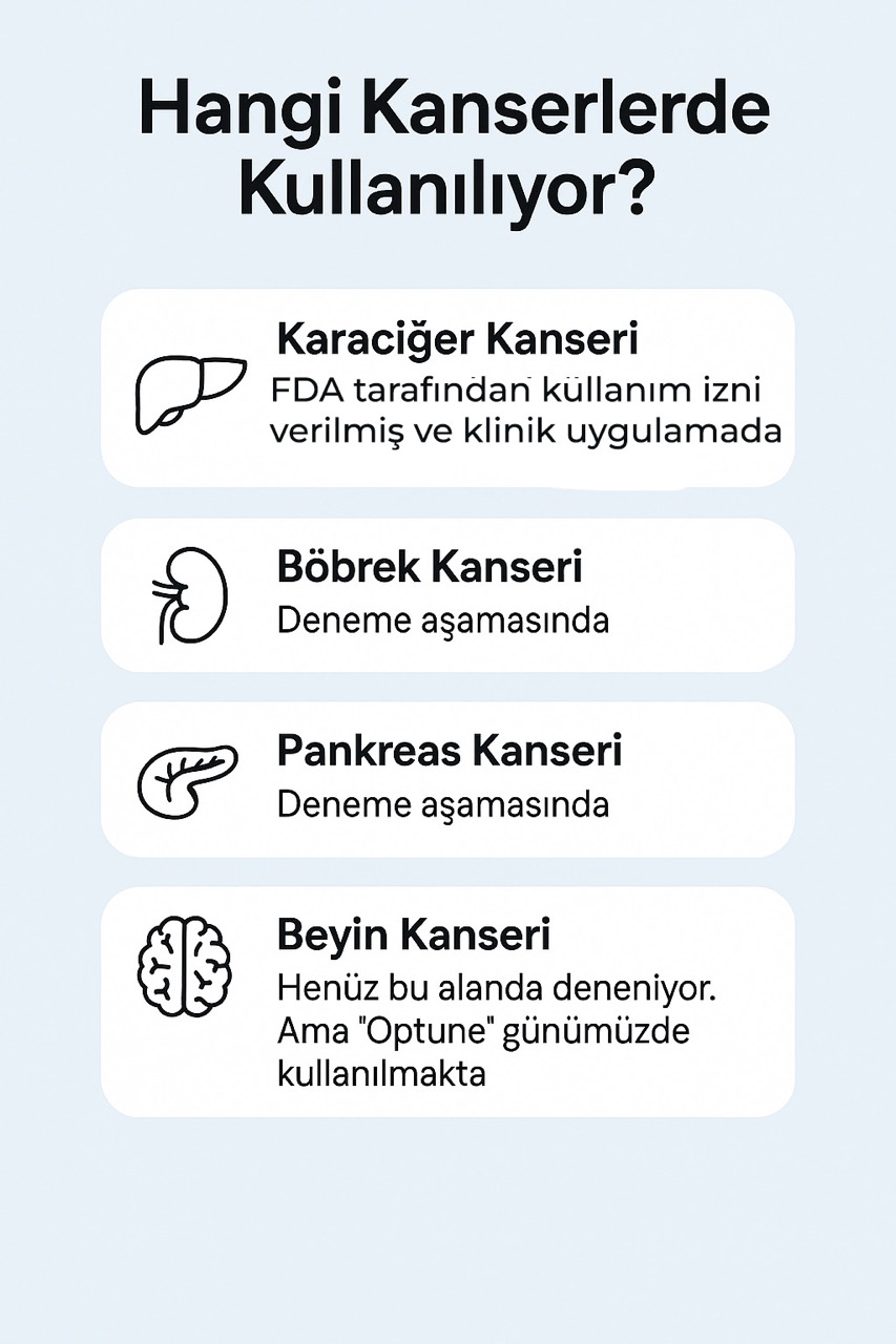 Histotripsiya hansı xərçənglərdə istifadə olunur