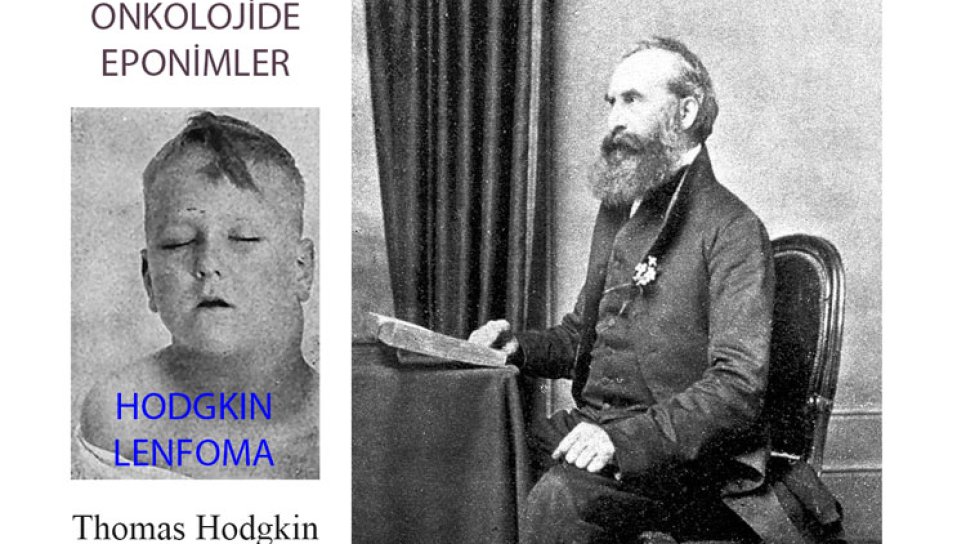 Hodgkin Lenfoma Nedir? Adı Nereden Gelmektedir?