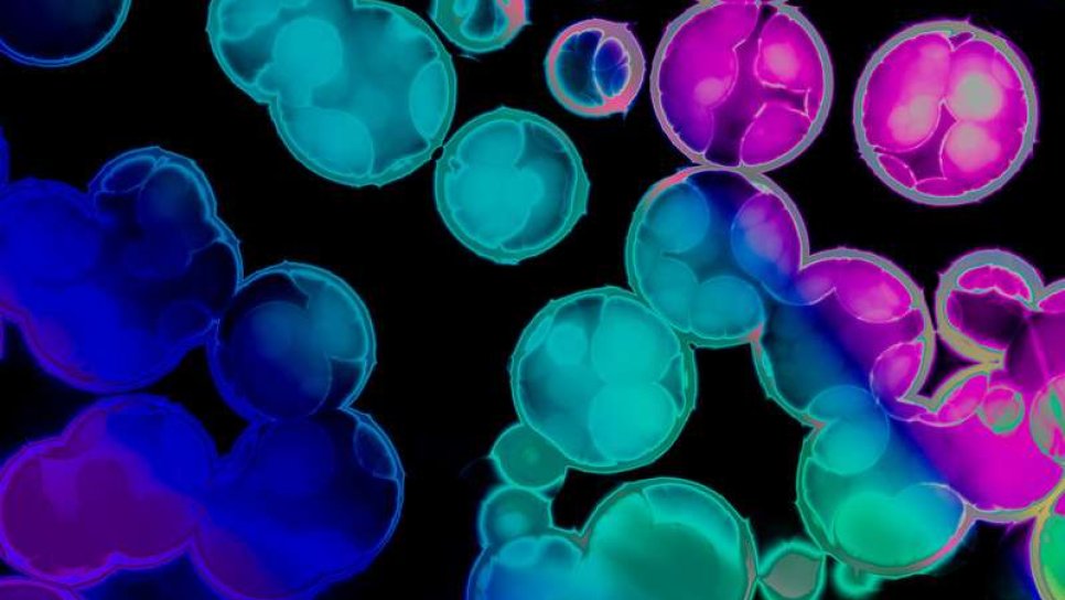 HPV İlişkili Kanserler İçin T-Hücre Reseptör Gen Tedavisi