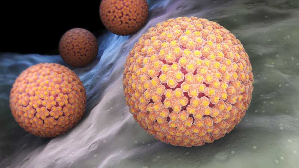 HPV – Kanser yapıcı bir virüsün bağışıklık sisteminden kaçma serüveni