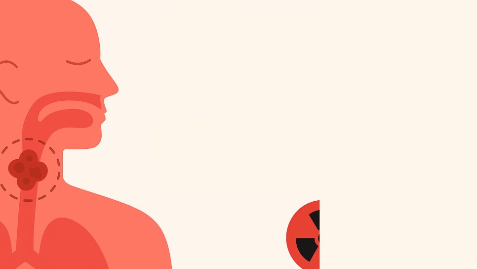 HPV-mənfi baş-boyun xərçəngində nivolumab və cavaba görə kimya-şüa müalicəsi