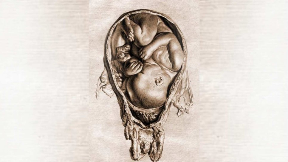 Hunters Anatomie des schwangeren Uterus 1774